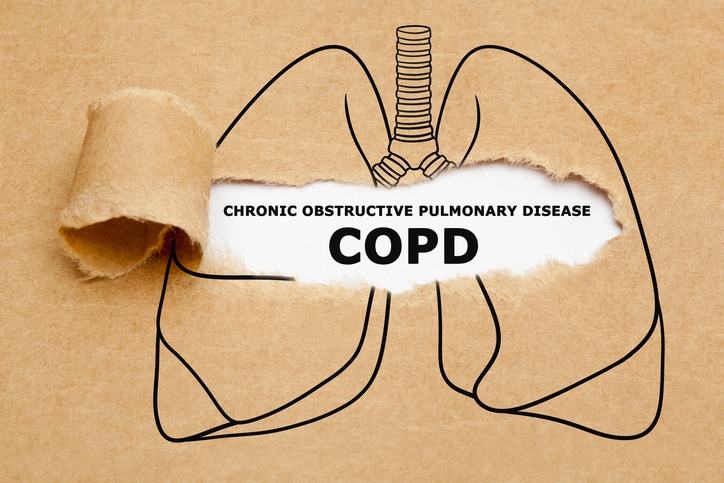 Understanding COPD Triggers and Symptoms